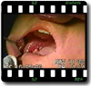 sequential image 01